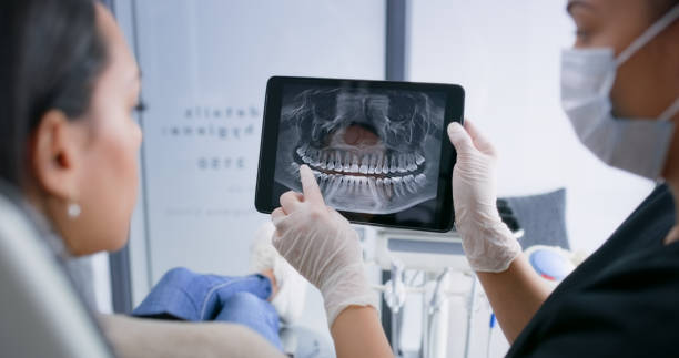 Licensed Tooth Extraction service in San Anselmo, CA - Smile Center Dentistry